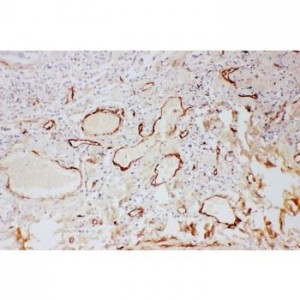 Adiponectin  Antibody