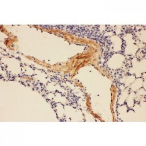 Adiponectin  Antibody