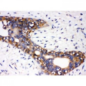 AGTR1  Antibody