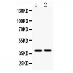 AHSG  Antibody