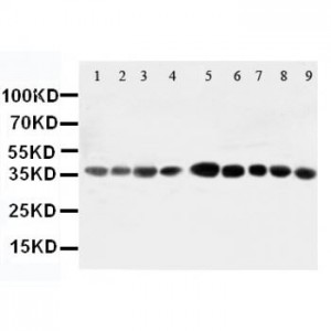 AIMP2/p38 Antibody