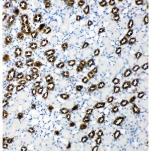 AKT3 Antibody