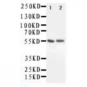 ALDH1A1 Antibody