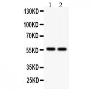 ALDH2  Antibody