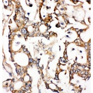 ALDH2 Antibody