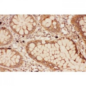 ALOX15  Antibody