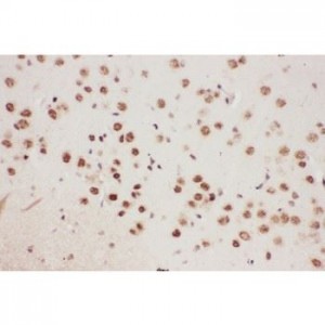 ALOX5 Antibody