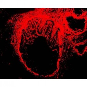 alpha-Smooth Muscle Actin Antibody (monoclonal)