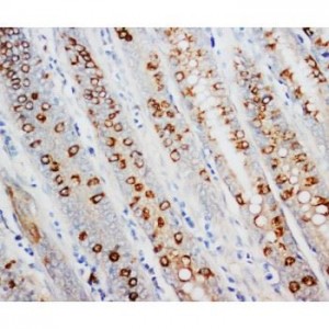 AMD1 Antibody
