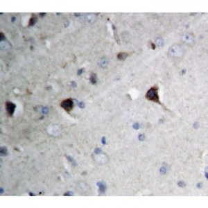 Amyloid beta precursor protein Antibody