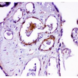 Angiotensin Converting Enzyme 1 Antibody