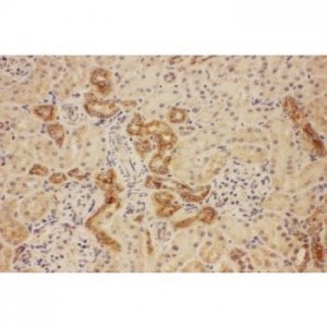 ATP7b Antibody