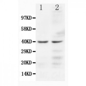 CCR5 Antibody