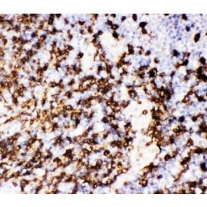 CD20  Antibody