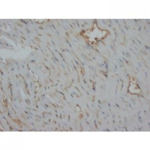 Desmin Antibody (monoclonal)