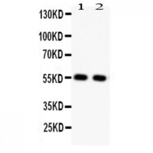 GLUT4  Antibody