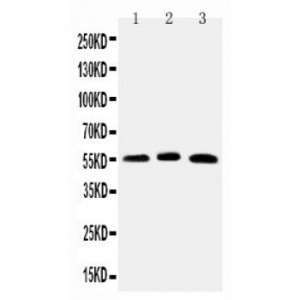 HNF6 Antibody