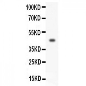 HOXA3 Antibody