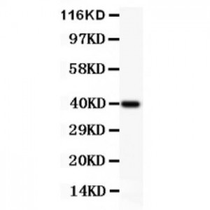 IKK alpha  Antibody