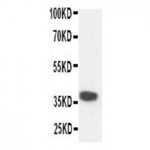 Kallikrein 5 Antibody