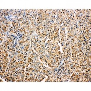 Kallistatin Antibody