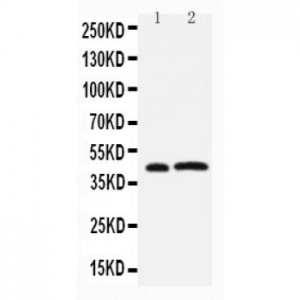 Leupaxin Antibody