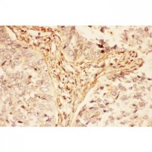 LIF  Antibody