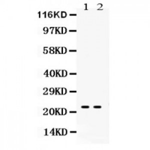 Lipocalin 2  Antibody
