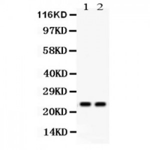 Lipocalin 2  Antibody