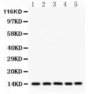 liver FABP  Antibody