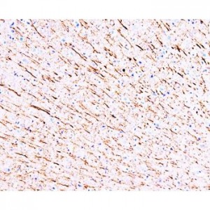 MAP1 Antibody (monoclonal)