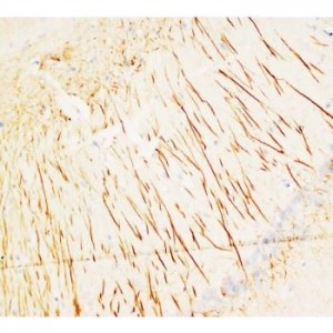 MAP2 Antibody (monoclonal)