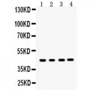 MASPIN  Antibody
