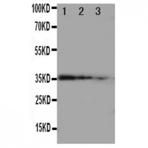 Matrilin 2 Antibody