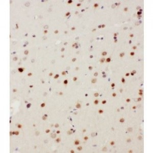MEKK3 Antibody