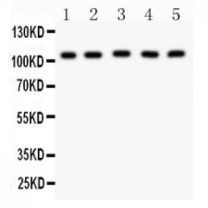 MSH2  Antibody