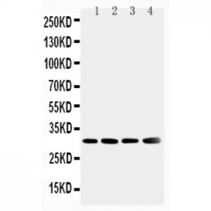 Superoxide Dismutase 3 Antibody