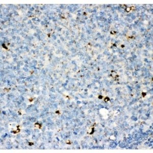 IL13 Antibody