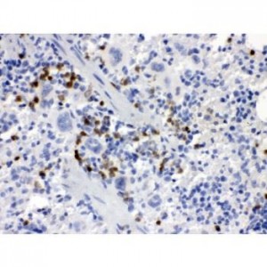 MCSF  Antibody
