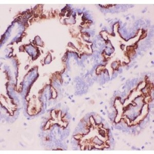 MUC1  Antibody