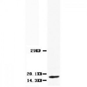 Myoglobin Antibody (monoclonal)