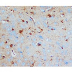 S-100(beta-subunit) Antibody (monoclonal)