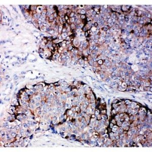 TIMP2 Antibody