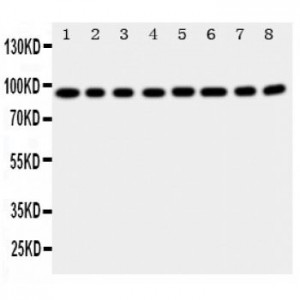 Factor VIII Antibody