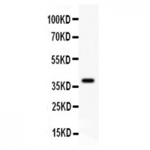 GAD67  Antibody