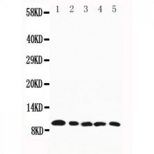 Macrophage Inflammatory Protein 1 beta