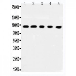 MCC Antibody