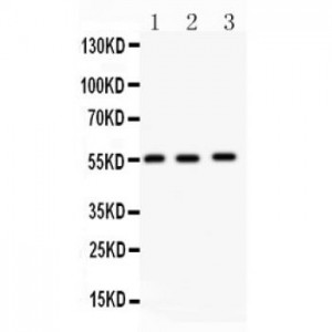 MMP14  Antibody