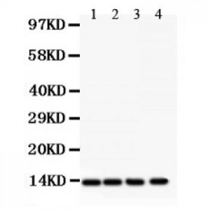 PDGF beta  Antibody
