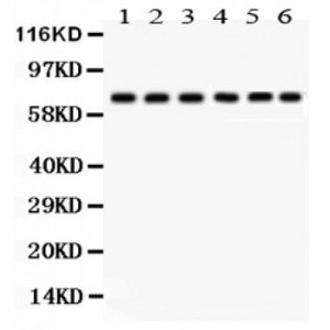 PKC delta Antibody